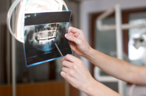 Der Arzt sieht sich das Röntgenbild des Kiefers an